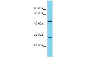Western Blotting (WB) image for anti-Tyrosyl-tRNA Synthetase 2, Mitochondrial (YARS2) (Middle Region) antibody (ABIN2790889) (YARS2 antibody  (Middle Region))