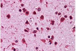 Human Brain, Cortex: Formalin-Fixed, Paraffin-Embedded (FFPE) (HSP90AB1 antibody  (N-Term))