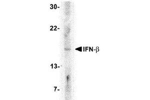 Western Blotting (WB) image for anti-Interferon, beta 1, Fibroblast (IFNB1) (Center) antibody (ABIN2474126)