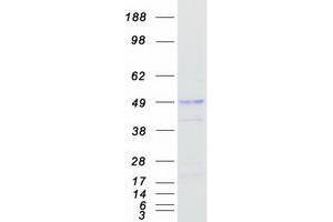 Validation with Western Blot