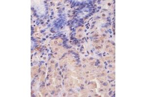 (ABIN650677 and ABIN2838644) staining EIF4E2 in human stomach tissue sections by Immunohistochemistry (IHC-P - paraformaldehyde-fixed, paraffin-embedded sections). (EIF4E2 antibody)