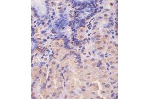 (ABIN650677 and ABIN2838644) staining EIF4E2 in human stomach tissue sections by Immunohistochemistry (IHC-P - paraformaldehyde-fixed, paraffin-embedded sections). (EIF4E2 antibody)