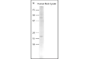 Western blot on human brain lysate using Rabbit antibody to pro BDNF (50-90): . (Pro BDNF antibody)