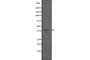 Western blot analysis of ADH6 using HUVEC whole cell lysates (ADH6 antibody)