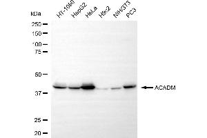 anti-Medium-Chain Specific Acyl-CoA Dehydrogenase, Mitochondrial (MCAD) antibody