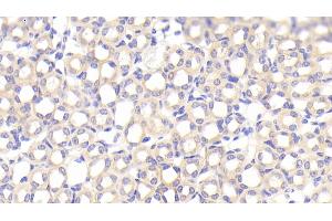 Detection of SFXN1 in Mouse Kidney Tissue using Polyclonal Antibody to Sideroflexin 1 (SFXN1) (SFXN1 antibody  (AA 2-102))