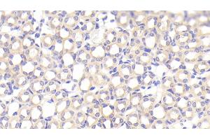 Detection of SFXN1 in Mouse Kidney Tissue using Polyclonal Antibody to Sideroflexin 1 (SFXN1)