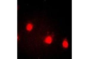 Immunofluorescent analysis of Cyclin E1 (pT77) staining in HEK293T cells. (Cyclin E1 antibody  (pSer77))