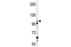 ZGRF1 antibody western blot analysis in K562 lysate (ZGRF1 antibody  (AA 38-66))