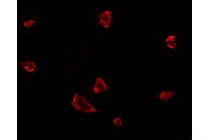Immunofluorescence (fixed cells) (IF/ICC) image for anti-Eukaryotic Translation Initiation Factor 2-alpha Kinase 3 (EIF2AK3) (pThr982) antibody (ABIN6255756)