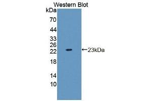 Detection of Recombinant GARS, Human using Polyclonal Antibody to Glycyl tRNA Synthetase (GARS) (GARS antibody  (AA 567-735))