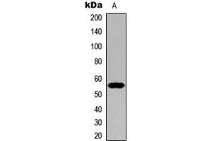 Western blot analysis of Cytochrome P450 21A2 expression in HeLa (A) whole cell lysates. (CYP21A2 antibody  (Center))
