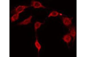 ABIN6267667 staining NIH-3T3 by IF/ICC. (CDC37 antibody  (pSer13))