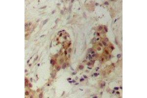 Immunohistochemistry (IHC) image for anti-Protein Regulator of Cytokinesis 1 (PRC1) antibody (ABIN7308218)