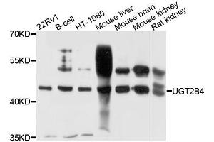 Western blot analysis of extracts of various cells, using UGT2B4 antibody. (UGT2B4 antibody)
