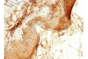 Immunohistochemistry of paraffin-embedded human skin tissue using ABIN7151902 at dilution of 1:100 (EPS15L1 antibody  (AA 585-864))