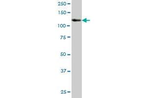 STK10 MaxPab polyclonal antibody. (STK10-A antibody  (AA 12-144))