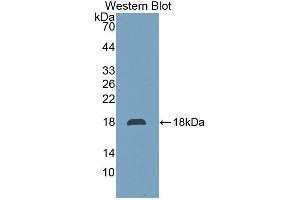 Detection of Recombinant TMEM27, Rat using Polyclonal Antibody to Transmembrane Protein 27 (TMEM27) (TMEM27 antibody  (AA 15-141))