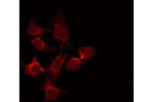 ABIN6272266 staining COS7 by IF/ICC. (CSNK1G1 antibody)