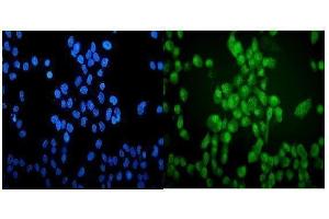 IF analysis of VCP using anti-VCP antibody (ABIN3043958). (VCP antibody  (C-Term))
