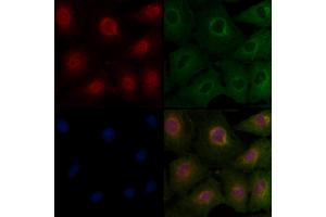 ABIN6263554 and ABIN6277124 staining  cells by IF/ICC. (NDRG1 antibody  (C-Term))