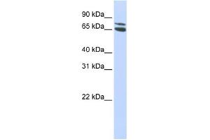 WB Suggested Anti-ZBTB48 Antibody Titration: 0. (ZBTB48 antibody  (Middle Region))