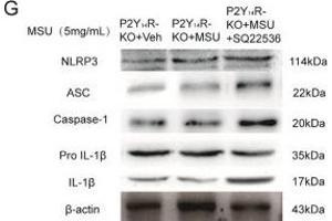 Decreased cAMP exaggerated acute gouty arthritis in P2Y14R-KO rats. (NLRP3 antibody  (AA 15-120))