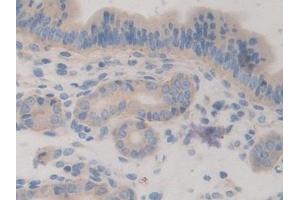 Immunohistochemistry (IHC) image for anti-Chordin (CHRD) (AA 422-635) antibody (ABIN7441952)