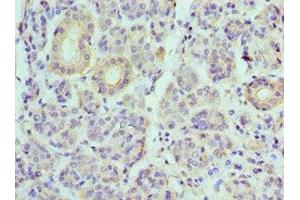 Immunohistochemistry of paraffin-embedded human salivary gland tissue using ABIN7175230 at dilution of 1:100 (ATP6V1B1 antibody  (AA 1-280))