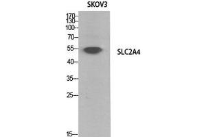 Western Blot analysis of SKOV3 cells using GLUT-4 Polyclonal Antibody at dilution of 1:1000. (GLUT4 antibody)