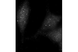 Immunofluorescence staining of Autophagy UVRAG antibody (ABIN388588 and ABIN2849986) on Methanol-fixed HeLa cells. (UVRAG antibody  (AA 120-152))