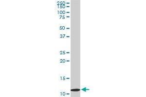 TIMM9 monoclonal antibody (M01), clone 1D6. (TIMM9 antibody  (AA 1-89))
