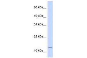 Image no. 1 for anti-Cellular Retinoic Acid Binding Protein 2 (CRABP2) (AA 72-121) antibody (ABIN6743084) (CRABP2 antibody  (AA 72-121))