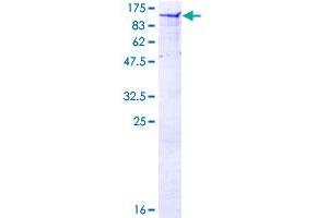 Calpastatin Protein (CAST) (AA 1-686) (GST tag)