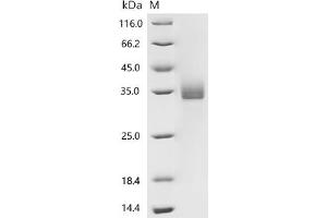 CD72 Molecule (CD72) (AA 117-359) protein (His tag)