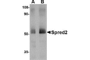 Western Blotting (WB) image for anti-Sprouty-Related, EVH1 Domain Containing 2 (SPRED2) (Middle Region) antibody (ABIN1031103) (SPRED2 antibody  (Middle Region))