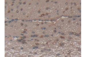 DAB staining on IHC-P; Samples: Rat Brain Tissue (FAS antibody  (AA 21-170))