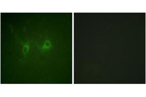 Immunofluorescence analysis of COS7 cells, using RGS16 (Ab-168) Antibody. (RGS16 antibody  (AA 141-190))