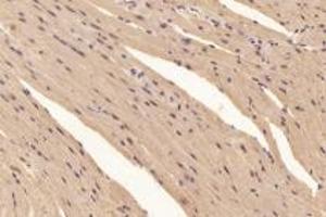 Immunohistochemistry analysis of paraffin-embedded mouse heart using,PYM (ABIN7074992) at dilution of 1: 6000 (Partner of Y14 and Mago (PYM1) antibody)