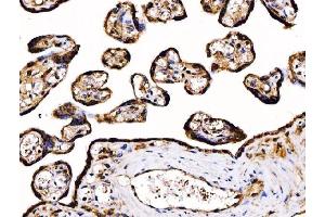 IHC analysis of PDIA6 using anti-PDIA6 antibody (ABIN7600554). (PDIA6 antibody  (AA 20-440))