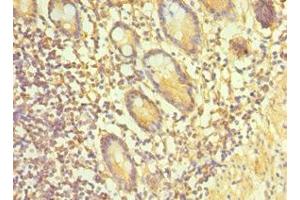 Immunohistochemistry of paraffin-embedded human small intestine tissue using ABIN7164900 at dilution of 1:100 (TAC1 antibody  (AA 1-129))