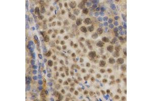 Immunohistochemistry (Paraffin-embedded Sections) (IHC (p)) image for anti-ELAV (Embryonic Lethal, Abnormal Vision, Drosophila)-Like 1 (Hu Antigen R) (ELAVL1) (AA 1-326) antibody (ABIN3022231)