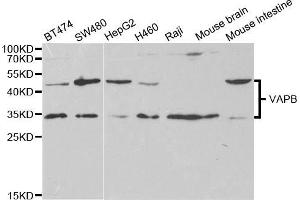 Western blot analysis of extracts of various cell lines, using VAPB antibody (ABIN5973099) at 1/1000 dilution. (VAPB antibody)