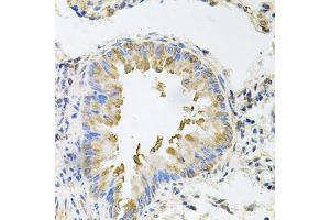 Immunohistochemistry of paraffin-embedded mouse lung using NCR3 antibody (ABIN5974302) at dilution of 1/100 (40x lens). (NCR3 antibody)