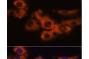 Immunofluorescence analysis of C6 cells using NDRG4 Polyclonal Antibody at dilution of 1:100. (NDRG4 antibody)