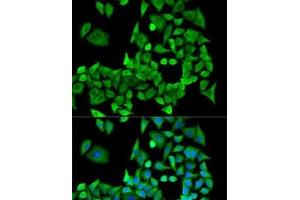 Immunofluorescence analysis of U2OS cells using PPP2R1A Polyclonal Antibody (PPP2R1A antibody)