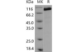 Western Blotting (WB) image for Protein tyrosine Phosphatase, Receptor Type, C (PTPRC) (Active) protein (ABIN7320005) (CD45 Protein)