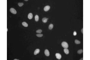 Immunofluorescent staining of A549 cells. (TOP2B antibody  (AA 1281-1494))
