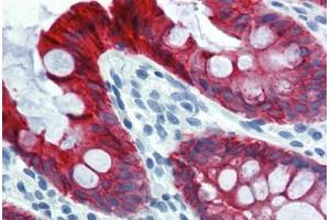 Colon, Human: Formalin-Fixed, Paraffin-Embedded (FFPE) (Cytokeratin 18 antibody)