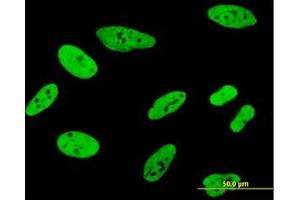 Image no. 5 for anti-Far Upstream Element (FUSE) Binding Protein 1 (FUBP1) (AA 27-137) antibody (ABIN599075) (FUBP1 antibody  (AA 27-137))